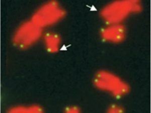 Chromosomes hybridized to a telomeric probe